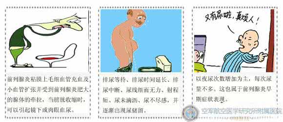 前列腺临床表现有哪些 前列腺临床表现有哪些 空鼻症 它的临床表现有哪些