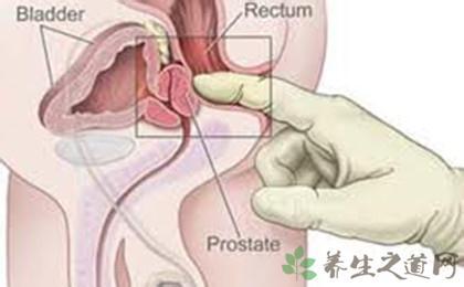 前列腺病自我按摩图解 前列腺按摩 前列腺这样按摩比较好