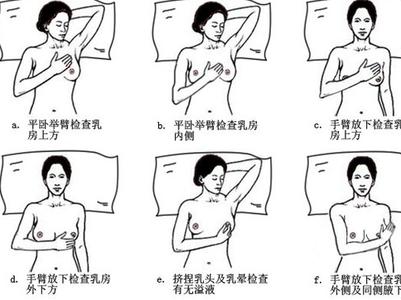 乳腺癌自我检查方法 乳腺癌自我检查方法 乳腺癌自我检查方法有哪些