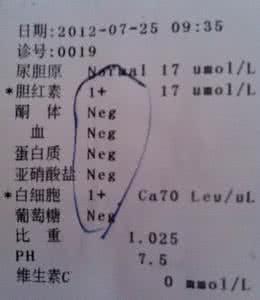 胆红素高的治疗方法 胆红素高是怎么回事