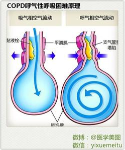 呼吸系统疾病 55张美图联播带你全面掌握呼吸系统疾病