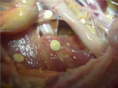 霉菌性阴炎的症状 霉菌性阴炎症状 霉菌性阴炎哪些症状需注意