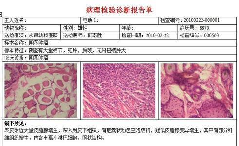 去除腿毛的方法 阴茎毛太多怎么办 去除方法介绍