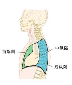纵隔肿瘤的症状 纵隔肿瘤 它的临床表现是什么
