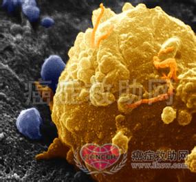 麝香牛黄丸 祖传秘方：恶性黑色素瘤验方牛黄麝酥丸