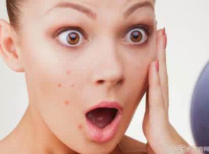 孕妇长痘痘可以擦什么 孕妇长痘痘怎么调理