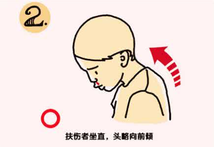 高血压流鼻血止血妙招 流鼻血怎么止血 这些妙招来帮你