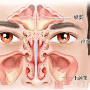 鼻塞流脓鼻涕 鼻窦炎鼻塞怎么办 鼻塞流脓涕，不一定是感冒，还有可能是鼻窦炎！