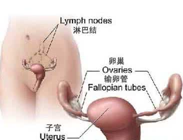 腹膜间皮瘤怎么治疗 腹膜间皮瘤 怎么治疗腹膜间皮瘤