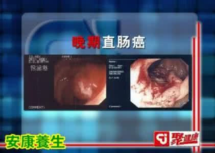 腹式呼吸唱歌怎么用力 20151106聚健康《抗癌力》5:腹式呼吸提高抗癌力,通过舌相看癌症状态,如果可以进食说明这个人有救,和胃止呕外敷方.癌症是一种身心疾病,首先应该从心理上进行调整。