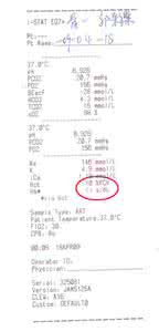 血气分析怎么抽 血气分析