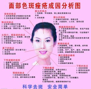 如何预防妇科病 如何预防妇科病 女性健康须知