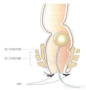 宝宝蛲虫病肛门图片 第七章 肛门病