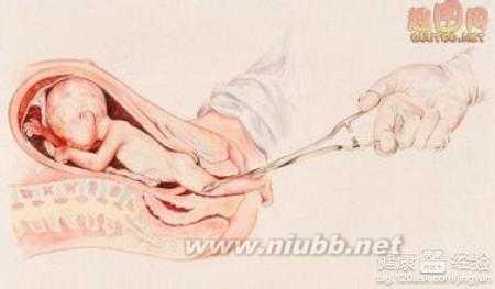 引产一次等于人流几次 引产和人流哪个危害大