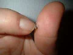 各种疣的图片 各种疣3方