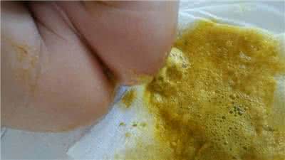 宝宝大便干燥怎么办 宝宝大便干燥怎么办 怎样观察宝宝的大便