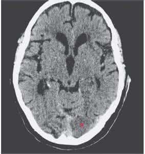 青蛙的特征 NEJM：“青蛙征”，你造吗？