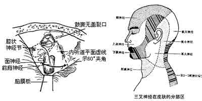 成都万年医院面瘫正规 成都万年面瘫医院 儿童面瘫的病因是什么（成都万年医院）