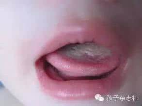 如何从舌头看健康 如何从舌头看宝宝的健康