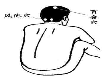 腰间盘突出艾灸疗法 艾灸疗法：头痛