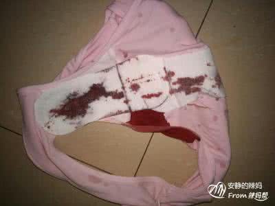 孕妇流鼻血是什么原因 孕中期流血是什么原因 孕中期出血是什么原因