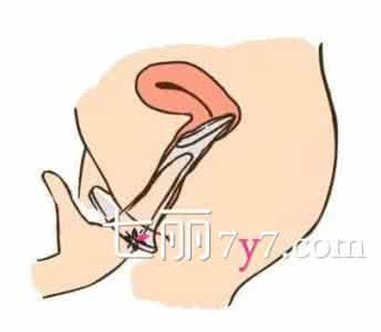 避孕套能避免艾滋病吗 避孕套能避免艾滋病吗 戴避孕套注意4要点 避免意外怀孕