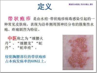 中医治疗带状疱疹浅析 中医治疗带状疱疹中心 带状疱疹病理及中医治疗方法小析