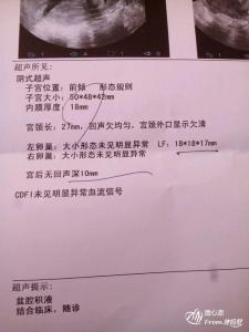 排卵期子宫内膜厚度 排卵期子宫内膜厚正常标准