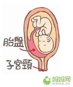 羊水破了是什么症状 羊水破了是什么症状 羊水破了是啥症状?过来妈咪这么说!
