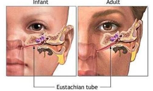 中耳炎耳朵痛 怎么辨别耳朵痛与中耳炎?