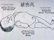 白斑的发病原因是什么 新生儿破伤风 它的发病原因是什么