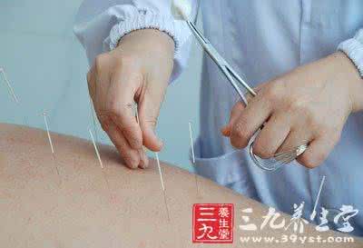 中医颈椎病的治疗方法 颈椎病治疗方法 中医针灸帮你解决