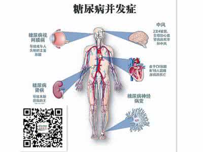 心血管疾病的急救知识 疾病急救的日常知识