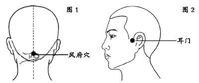 突聋后耳鸣多久能消失 耳鸣会致聋吗 耳机久挂易致聋 中医教你4招健耳