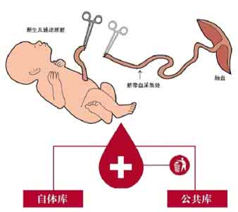 储存脐带血有用吗 存脐带血有用吗 存脐带血真的有用吗?