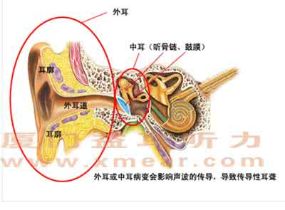 神经性耳龙聋能恢复吗 耳聋分类