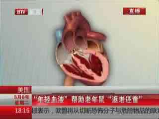 真人真事返老还童 年轻血液能返老还童你真的信了?