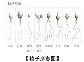 导致精子畸形的原因 精子畸形高是什么原因导致的