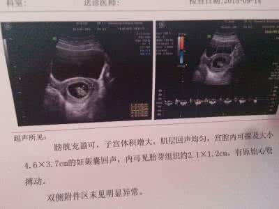 b超看胎儿性别准确率 b超看胎儿性别准确率 看看这个部位，就能准确判断胎儿性别！