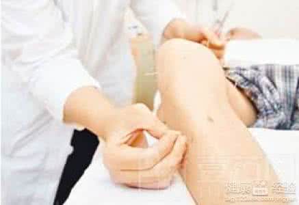 关节炎的治疗方法 关节炎治疗方法 关节炎这样治疗比较好