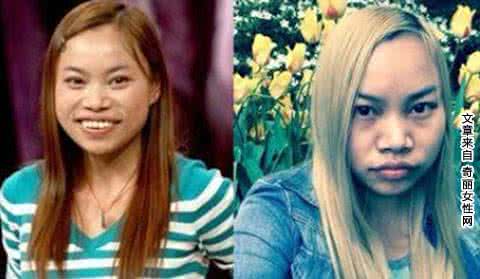 凤姐整容后照片 凤姐整容后照片老公 凤姐整容后照片 大方宣称自己整容