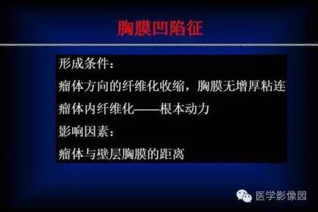 肺癌 x光征象 不可不看的肺癌CT征象总结！