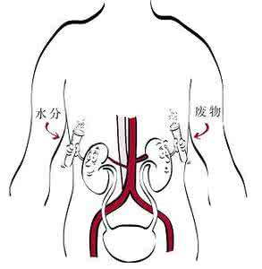 清洗肾脏的绝好秘方 清洗你肾脏的绝好秘方