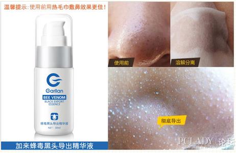 去黑头最好的牌子 去黑头最好的牌子 去黑头最好的品牌