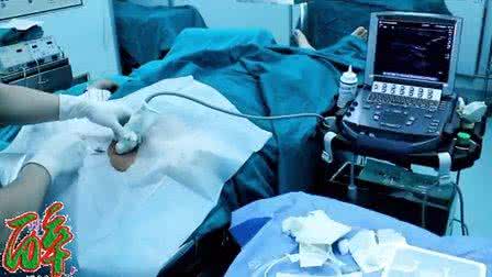 超声引导下深静脉穿刺 实时超声引导下经皮右颈内静脉穿刺置管术的应用价值