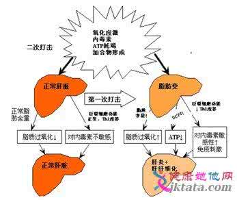 脂肪肝患者症状 脂肪肝症状 患上脂肪肝的7征兆