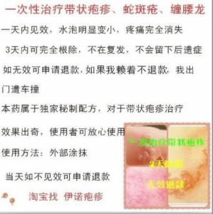 雄黄治疗带状疱疹 带状疱疹怎么治疗 关于雄黄治疗带状疱疹及其功效