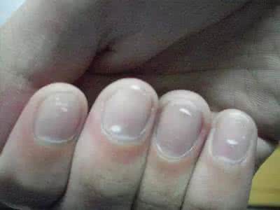 男性肾虚的表现症状 男性肾虚的症状有哪些 男性指甲一旦出现这种症状，就是肾虚！