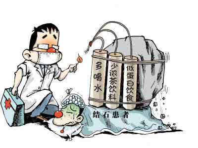 肾结石中药处方 中药铺传出的肾结石方！