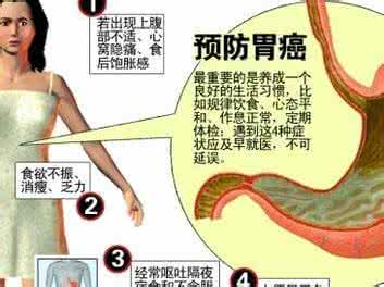 胃癌的早期症状 图解:健康解码|胃癌症状